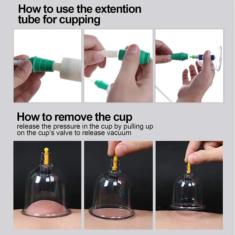 6Pcs Vacuum Cupping Set with Pump Gun – Suction Massage Cups for Back, Body Detox & Anti-Cellulite Care - Image 4