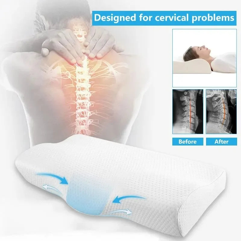Butterfly-Shaped Memory Foam Cervical Pillow – Orthopedic Neck Protection for Better Sleep - Image 4